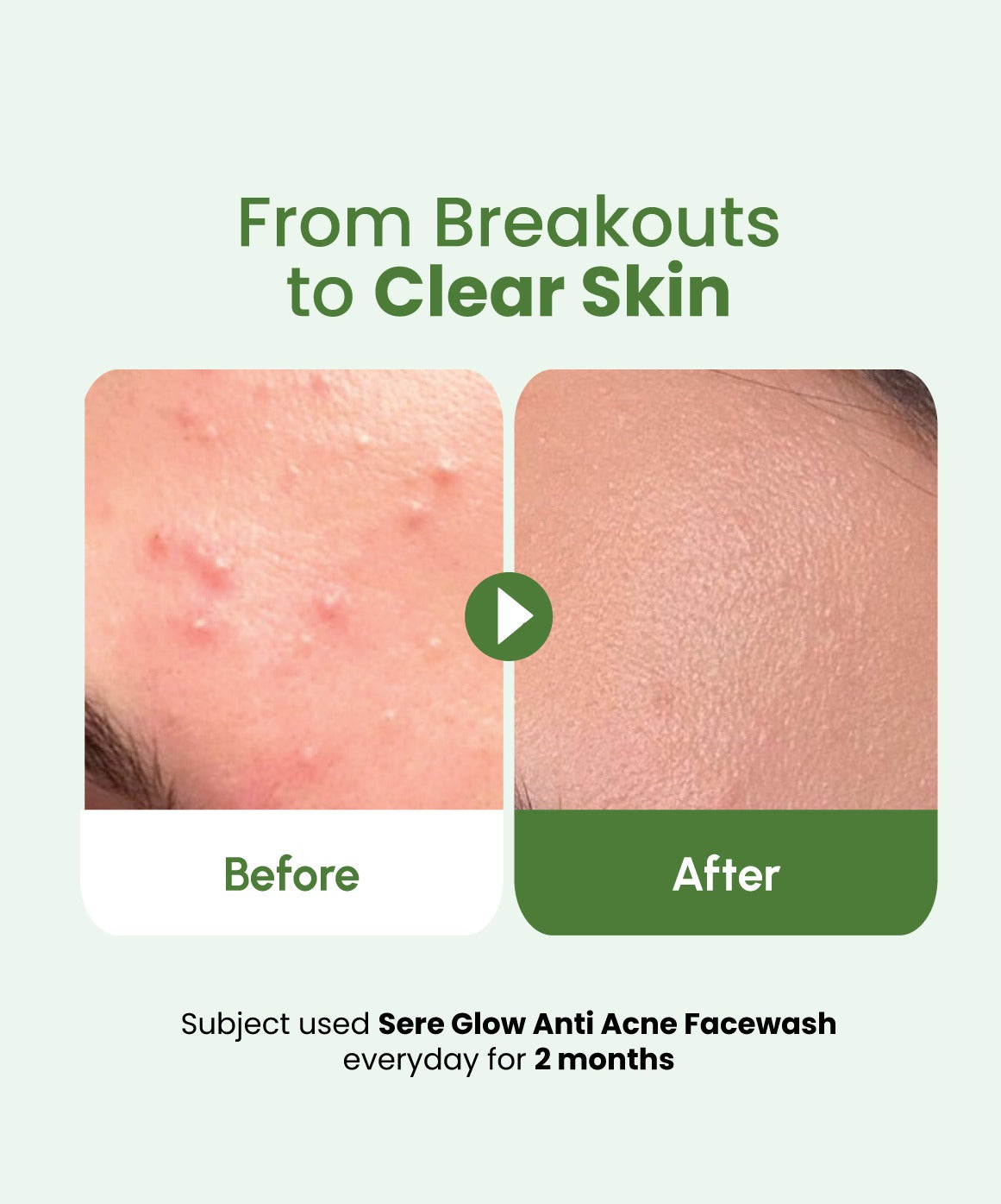SereGlow Anti-Acne Whitening Face Wash